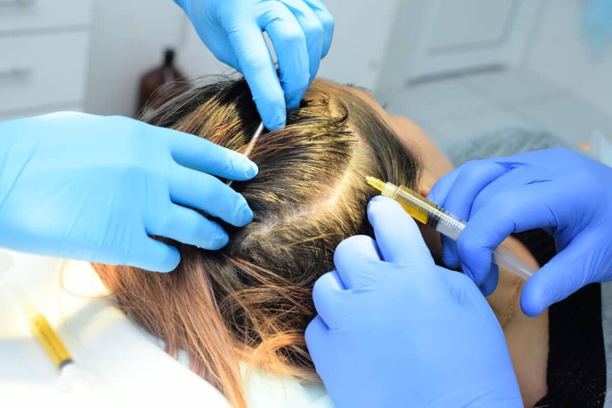 Hair Loss Restoration In Colts Neck, NJ - Reveal Image Aesthetics &  Regenerative Medicine
